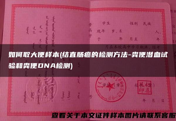 如何取大便樣本(結直腸癌的檢測方法-糞便潛血試驗和糞便DNA檢測)