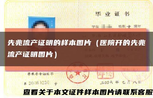 先兆流產證明的樣本圖片（醫院開的先兆流產證明圖片）縮略圖
