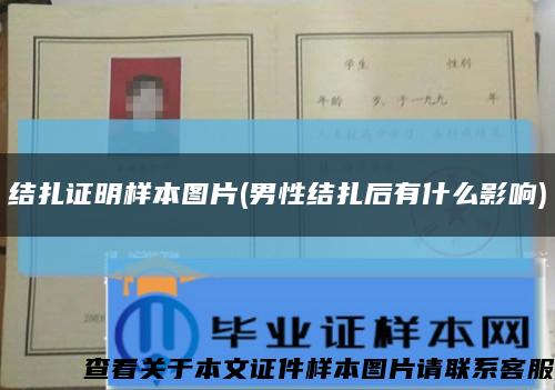結扎證明樣本圖片(男性結扎后有什么影響)縮略圖