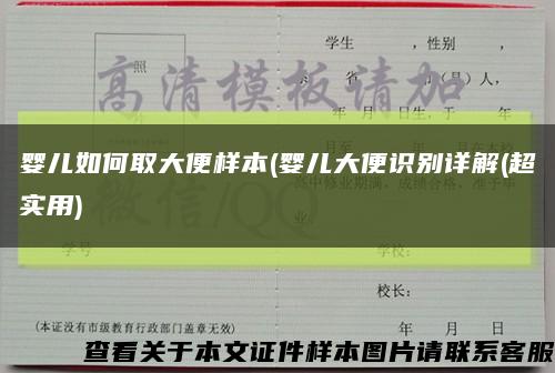 嬰兒如何取大便樣本(嬰兒大便識別詳解(超實用)縮略圖